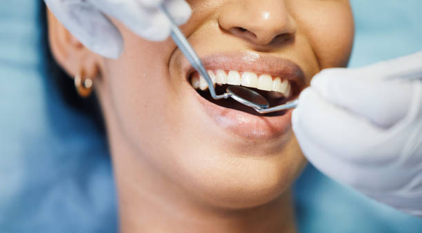 Urgent Tooth Repair in TN